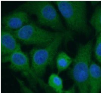 HuD Rabbit Polyclonal Antibody