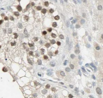 IFIT1B Rabbit Polyclonal Antibody