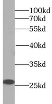 IGF1B Specific Rabbit Polyclonal Antibody