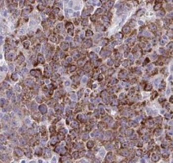 IGF1B Specific Rabbit Polyclonal Antibody