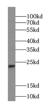 IMP3 Mouse Monoclonal Antibody