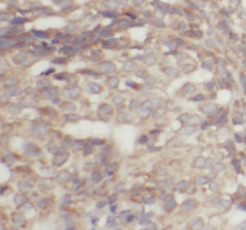IMP3 Mouse Monoclonal Antibody