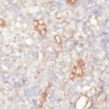 ITGA1 Rabbit Polyclonal Antibody