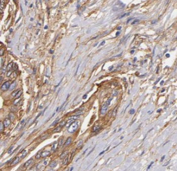 ITGB6 Antibody