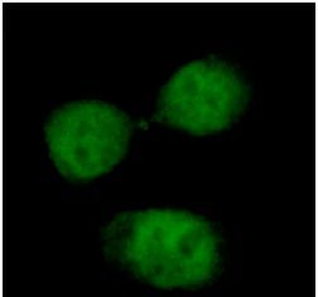 INTS8 Rabbit Polyclonal Antibody