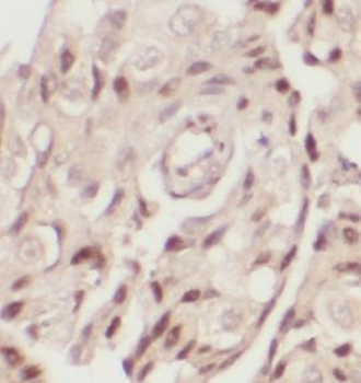 INTS8 Rabbit Polyclonal Antibody