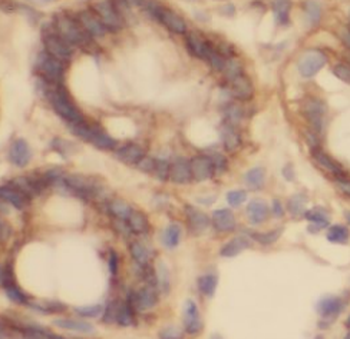 PLA2G6 Rabbit Polyclonal Antibody