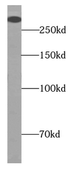 ITPR1 specific Rabbit Polyclonal Antibody