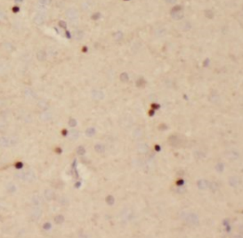 ITPR1 specific Rabbit Polyclonal Antibody