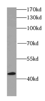 IVD Antibody