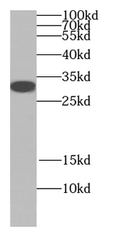 JSRP1 Rabbit Polyclonal Antibody