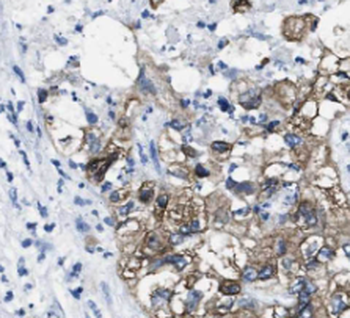 JSRP1 Rabbit Polyclonal Antibody