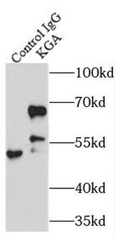 KGA/GAC Rabbit Polyclonal Antibody