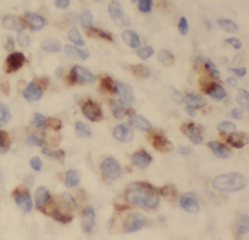 KGA/GAC Rabbit Polyclonal Antibody