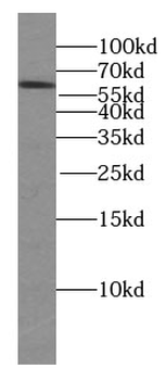 KGA/GAM/GAC Rabbit Polyclonal Antibody