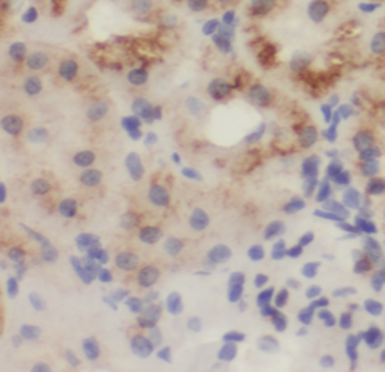 KGA/GAM/GAC Rabbit Polyclonal Antibody