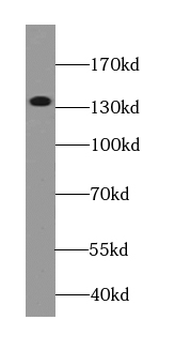 GSE1 Rabbit Polyclonal Antibody
