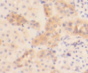 GSE1 Rabbit Polyclonal Antibody