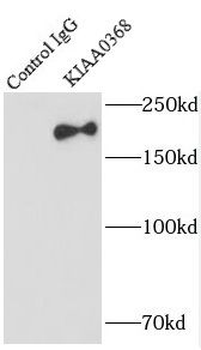 ECPAS Rabbit Polyclonal Antibody