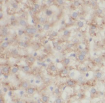 ECPAS Rabbit Polyclonal Antibody