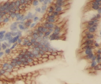 MARF1 Rabbit Polyclonal Antibody
