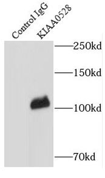 C2CD5 Rabbit Polyclonal Antibody