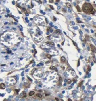 FERMT2 Rabbit Polyclonal Antibody