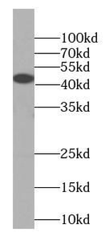 KISS1R Antibody