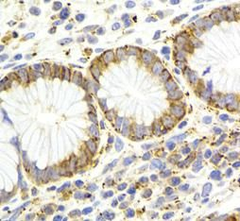 KISS1R Specific Rabbit Polyclonal Antibody