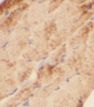 KLHL14 Specific Rabbit Polyclonal Antibody