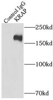 ITPRID2 Rabbit Polyclonal Antibody