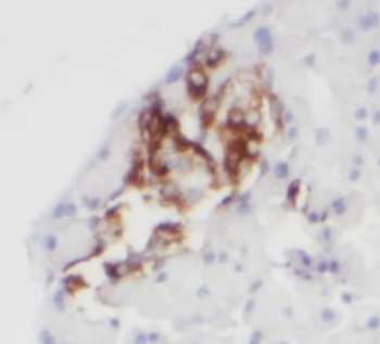 ITPRID2 Rabbit Polyclonal Antibody