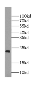 KRAS 2A specific Rabbit Polyclonal Antibody
