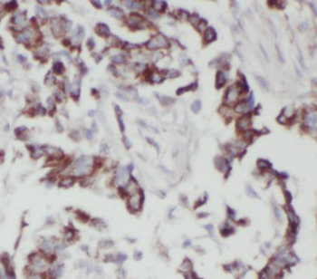 KRAS 2A specific Rabbit Polyclonal Antibody