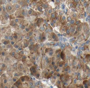 KRAS 2B specific Rabbit Polyclonal Antibody