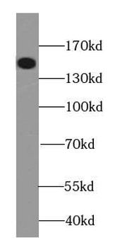 LATS2 Antibody