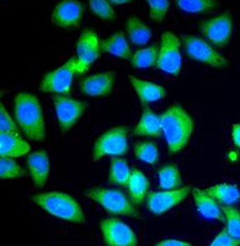 LC3B Specific Rabbit Polyclonal Antibody