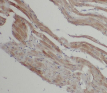 LC3B Specific Rabbit Polyclonal Antibody