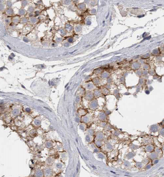 LDHC Specific Rabbit Polyclonal Antibody