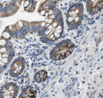 Lin28A specific Rabbit Polyclonal Antibody