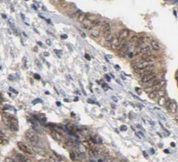 LORICRIN Rabbit Polyclonal Antibody