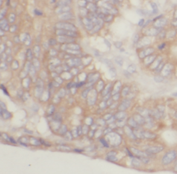 LPO Rabbit Polyclonal Antibody