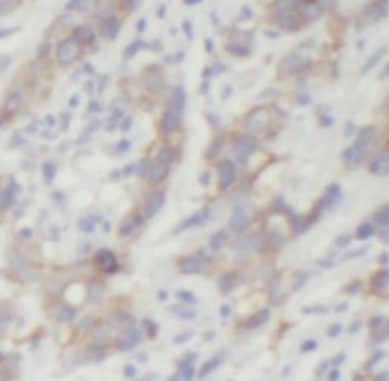 MAP2K4 Rabbit Polyclonal Antibody