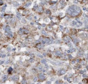 MMS19 Mouse Monoclonal Antibody