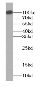 MPHOSPH8 Rabbit Polyclonal Antibody