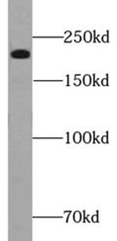 MYH7 Antibody