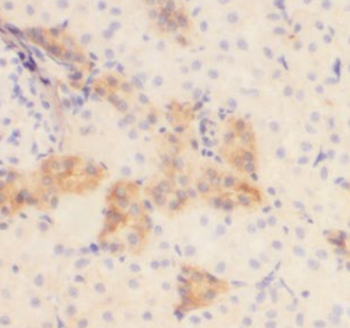 MYL5 Rabbit Polyclonal Antibody