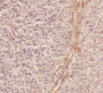 MYSM1 Specific Rabbit Polyclonal Antibody