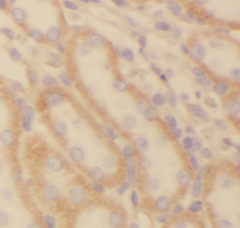 NDUFS5 Mouse Monoclonal Antibody