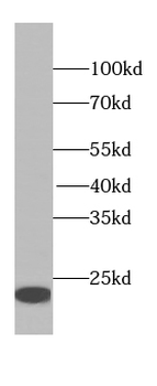 NFIX Antibody